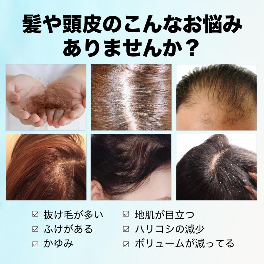 薬用育毛エッセンSPRING 育毛剤 リニュアール育毛 発毛促進 抜け毛予防