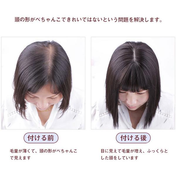 ウィッグ レディース ショート 自然 ヘアピース 薄毛 白髪隠し かつら 頭頂部 ストレート おしゃれ 美髪 普段使い 女性用 25cm 35cm |  | 02