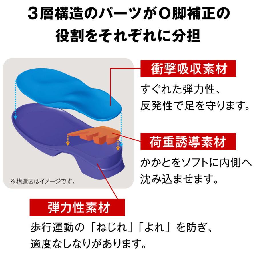アーチフィッター 402 O脚 ブラック 曲がった足をまっすぐに補正 アーチフィッター 402 O脚 ブラック 曲がった足をまっすぐに補正