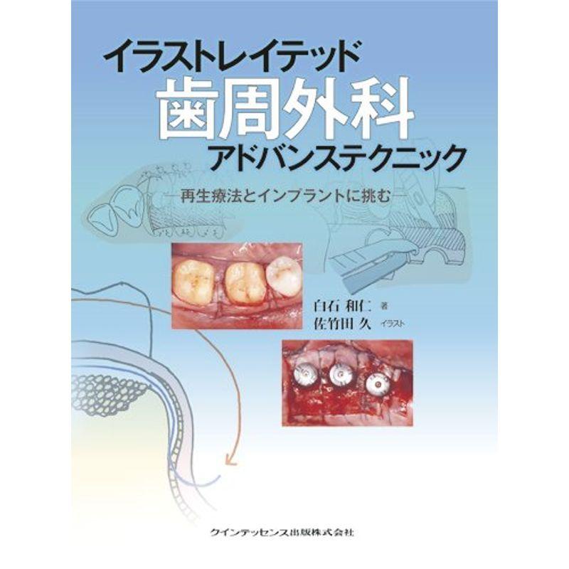 イラストレイテッド 歯周外科アドバンステクニック ヤフー店のイラストレイテッド ヤフー店 ワンダービート 歯周外科アドバンステクニック ならショッピング ランキングや口コミも豊富なネット通販 更にお得なpaypay残高も スマホアプリも充実で