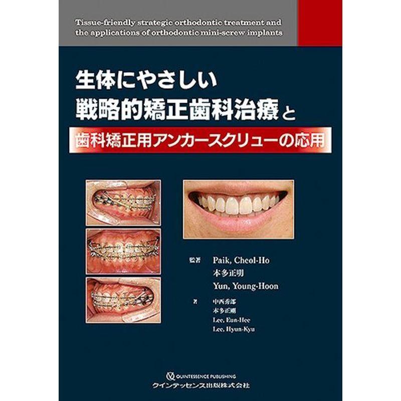 実践的リンガルブラケット矯正 | 松野 功 |本 | 通販 | Amazon