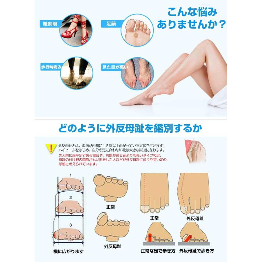 外反母趾 サポーター 矯正 ベルト 治療 フットケア 健康グッズ 足の痛み サポート 外反母趾ベルト 外反母趾 固定帯 圧迫サポート メール便送料無料 Yw049 Just Japan 通販 Yahoo ショッピング