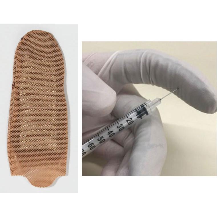 インスリン注射針防護　Nキャップ　「N-cap　M-3」 | 