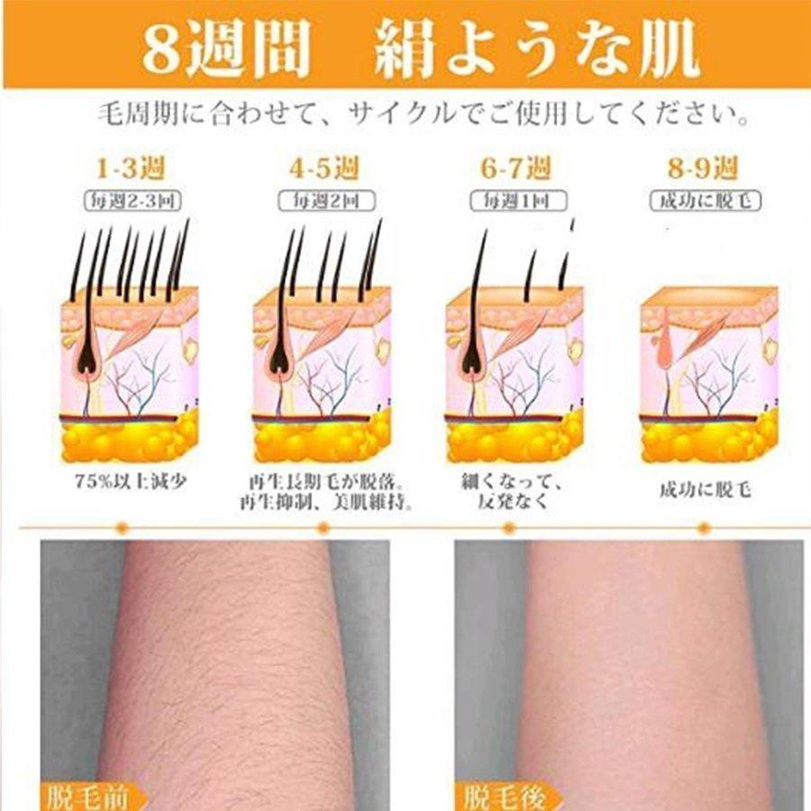 保障できる 家庭用脱毛器 顔 脇 光脱毛器 全身痛くない脱毛器 除毛フラッシュ 冷感 5段階調節可 Ipl光 レーザー 脱毛器 熱売り 脱毛機 50万発ショット Ledスクリーン New限定品 Www Sei Ba Gov Br
