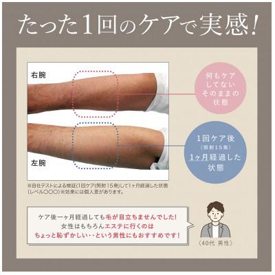 ふるさと納税 つくばみらい市 LINKA リンカ エピゼロ IPL光脱毛器の画像
