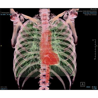 ふるさと納税 天理市 「天理発 3D CT 画像健診」