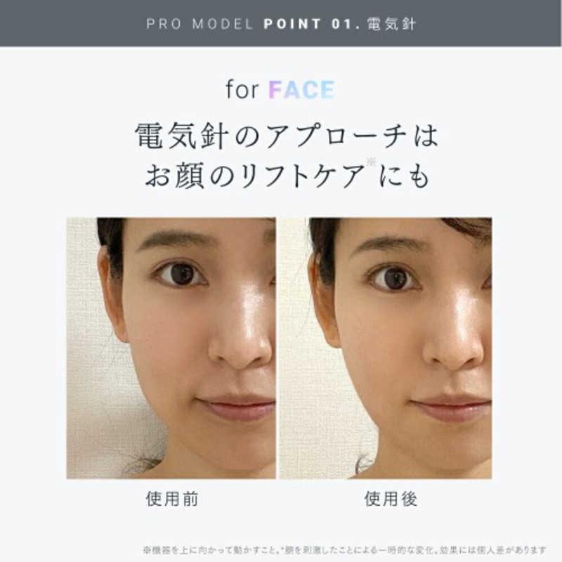 MYTREX 電気針 EMS HEAD SPA PRO(ヘッドスパ プロ) MT-EHP22B-B