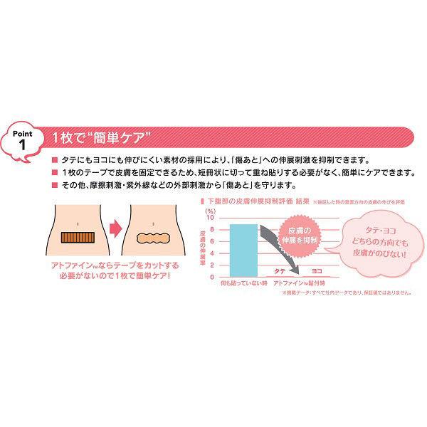 ニチバン アトファイン Mサイズ 6枚入り 傷あとケアテープ 帝王切開|y-lohaco|05