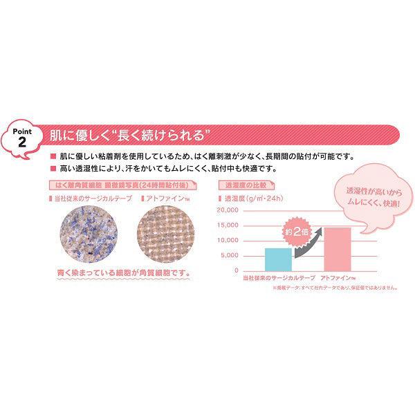 ニチバン アトファイン Mサイズ 6枚入り 傷あとケアテープ 帝王切開|y-lohaco|06