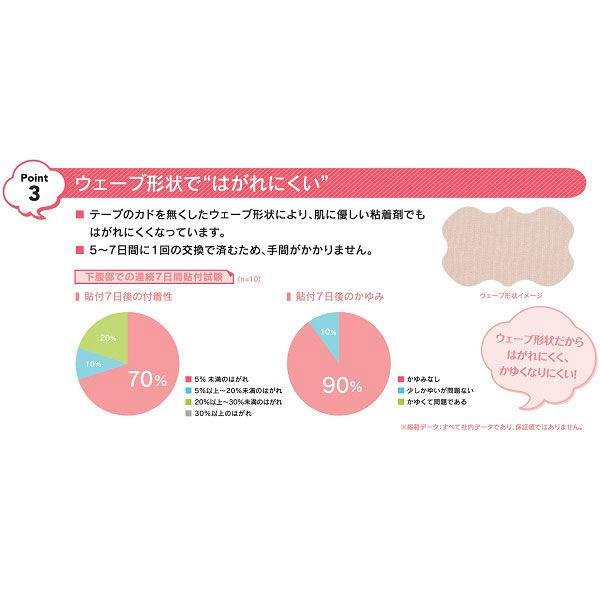 ニチバン アトファイン Mサイズ 6枚入り 傷あとケアテープ 帝王切開|y-lohaco|07