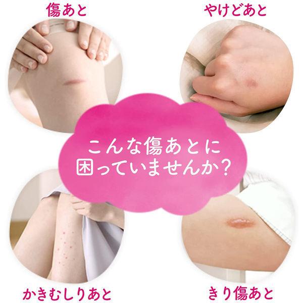 アットノンexジェル 小林製薬 第2類医薬品 評価