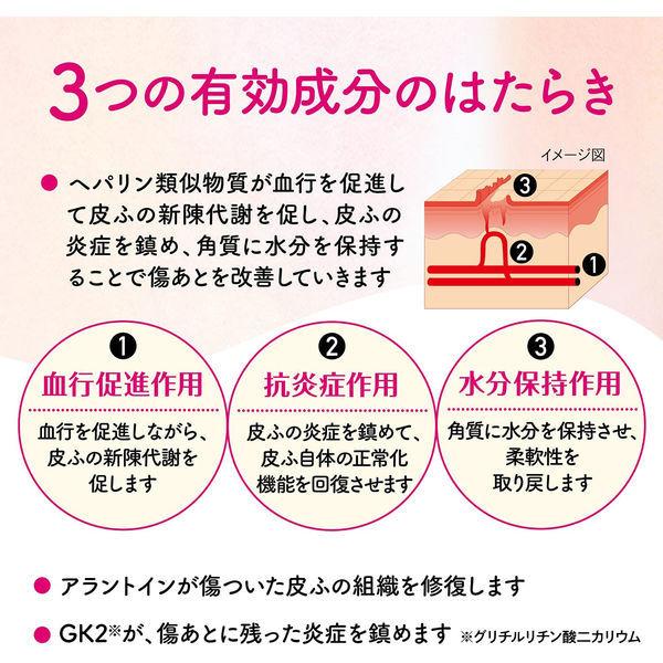 アットノンexジェル 小林製薬 第2類医薬品 評価