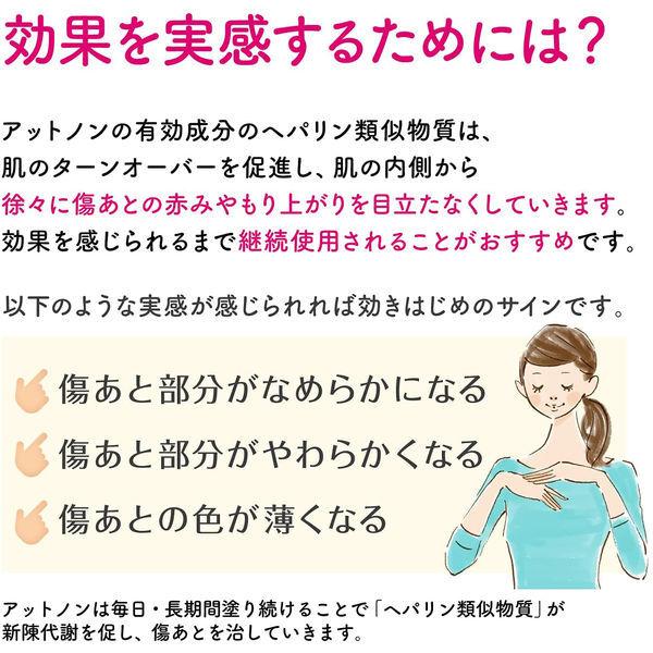 アットノンexジェル 小林製薬 第2類医薬品 評価