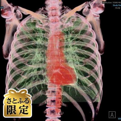 ふるさと納税 天理市 [さとふる限定]「天理発 3D CT 画像健診」