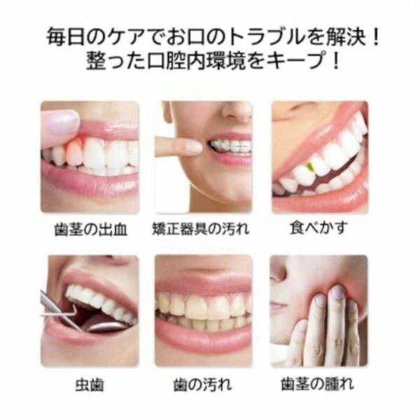 アントレックス 口腔洗浄器 スキ間シャワー JET |  | 07