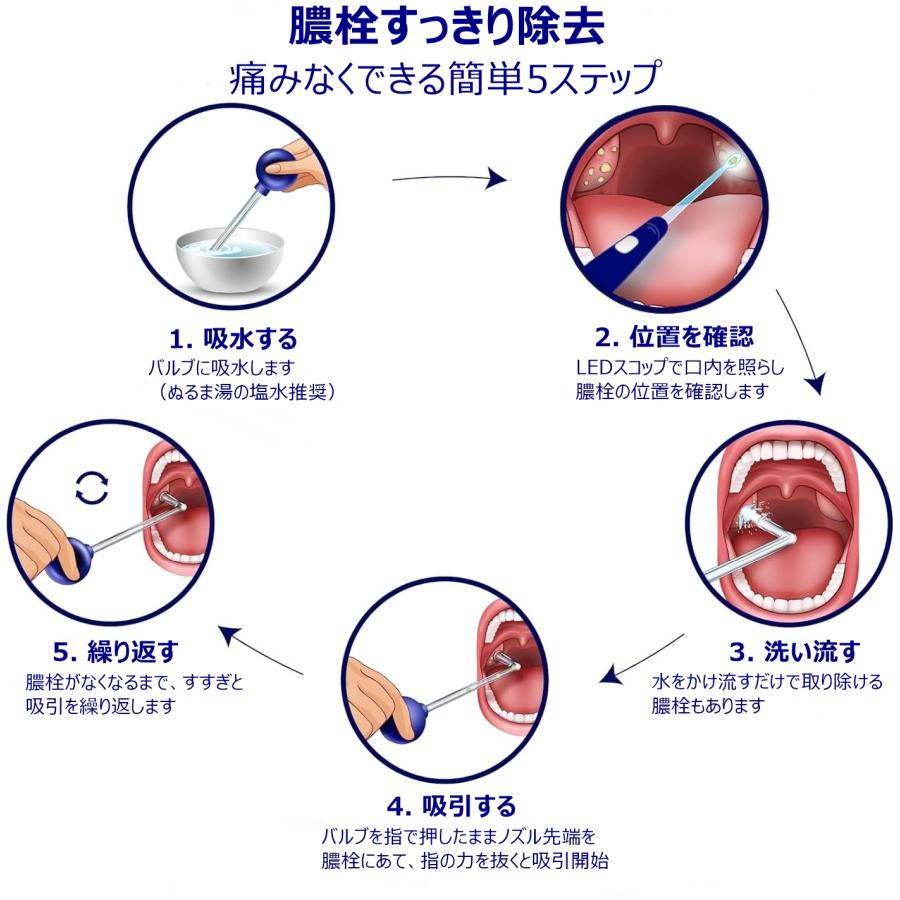 膿 栓 取り 方