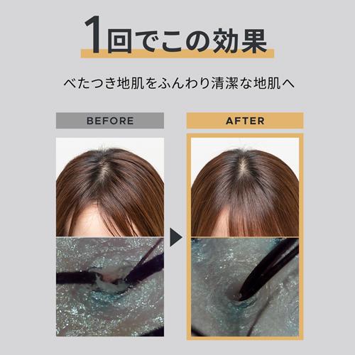 YA‐MAN（ヤーマン） ヘッドスパ 頭皮ケア ミーゼ ニードルヘッドスパ