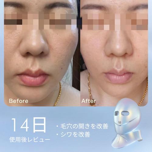 サロン専売家庭用美容器 京都市西京区】傷んだ髪を生きた髪へ―83歳オーガニック社長が35年守り