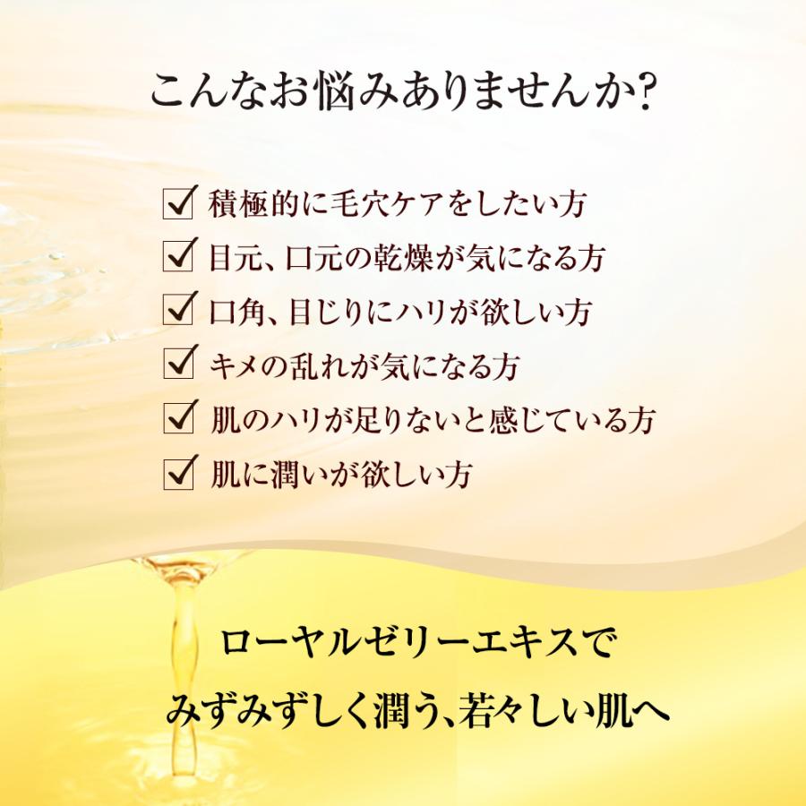 山田養蜂場 RJ 3点セット Sタイプ(乾性肌） 化粧水 美容液 美容クリーム ローション セラム ヒアルロン酸 コラーゲン セラミド 毛穴 黒ずみ 美肌 保湿 送料無料 | 山田養蜂場 | 01