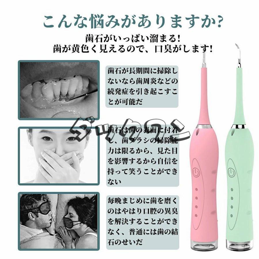 口腔洗浄機 歯鏡付き 電動ブラシ 口腔洗浄器 歯石取り スケーラー 超音波 電気歯クリーナー ☆新作入荷☆新品 歯用ツール 歯垢 超音波振動 高周波振動 歯茎 防水 電気歯洗浄機 口腔洗浄機 歯鏡付き 電動ブラシ 口腔洗浄器 歯石取り スケーラー 超音波 電気歯クリーナー ☆新作入荷☆新品 歯用ツール 歯垢 超音波振動 高周波振動 歯茎 防水 電気歯洗浄機