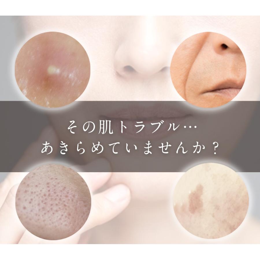 美顔器 ミライエ EMSマルチフェイシャル リフトアップ オールインワン