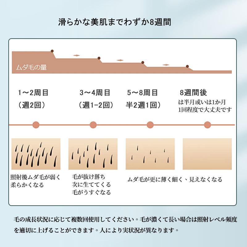 脱毛器 レーザー 永久脱毛 脱毛器 レーザー 永久脱毛 IPL光脱毛器 光美容器 冷感脱毛