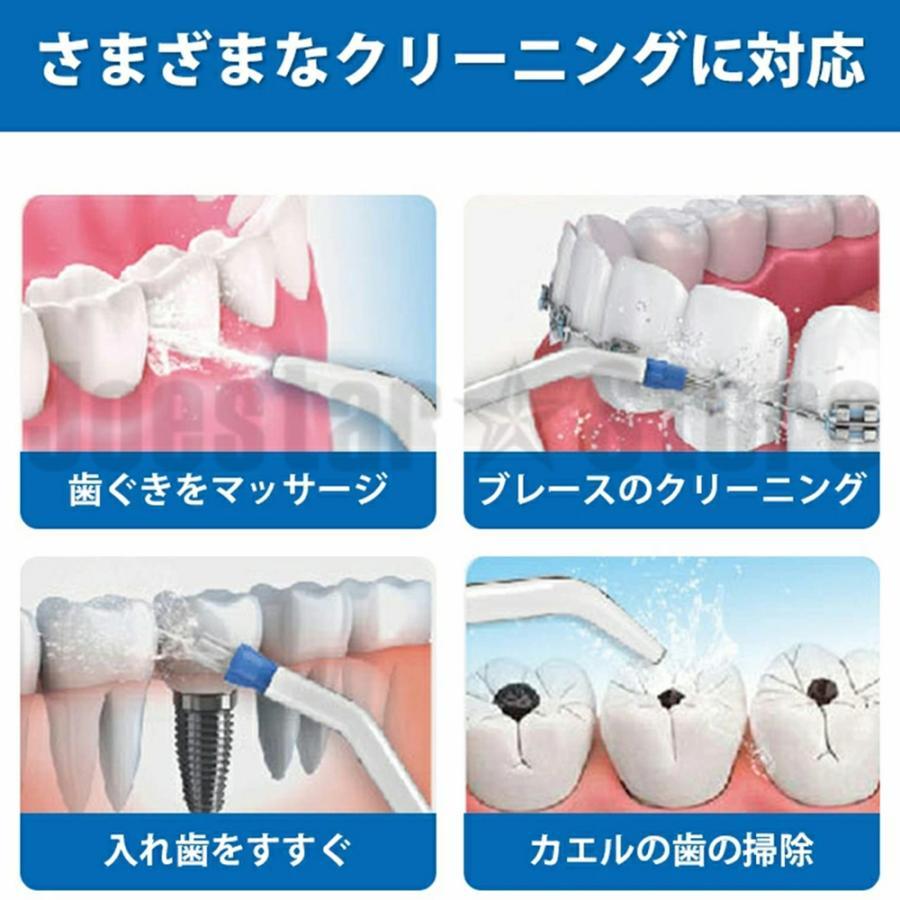 口腔洗浄機 歯垢洗浄 歯周ポケット洗浄 舌の汚れをケア 口腔洗浄 口腔洗浄機 歯垢洗浄 歯周ポケット洗浄 舌の汚れをケア 口腔洗浄