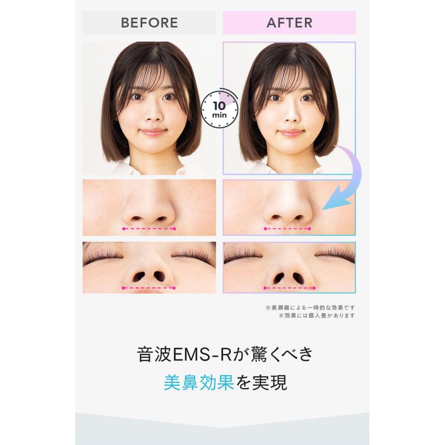 LUXCEAR Fornez PRO ルクセア フォーネス プロ 鼻専用美顔器 ノーズ