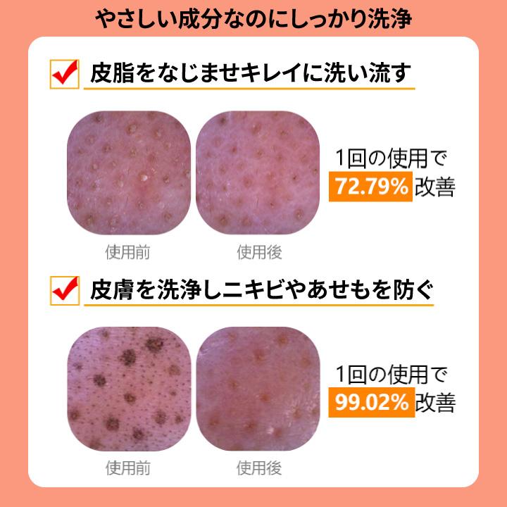 Freemay リアル ディープ クレンジング オイル 330ml メイク落とし