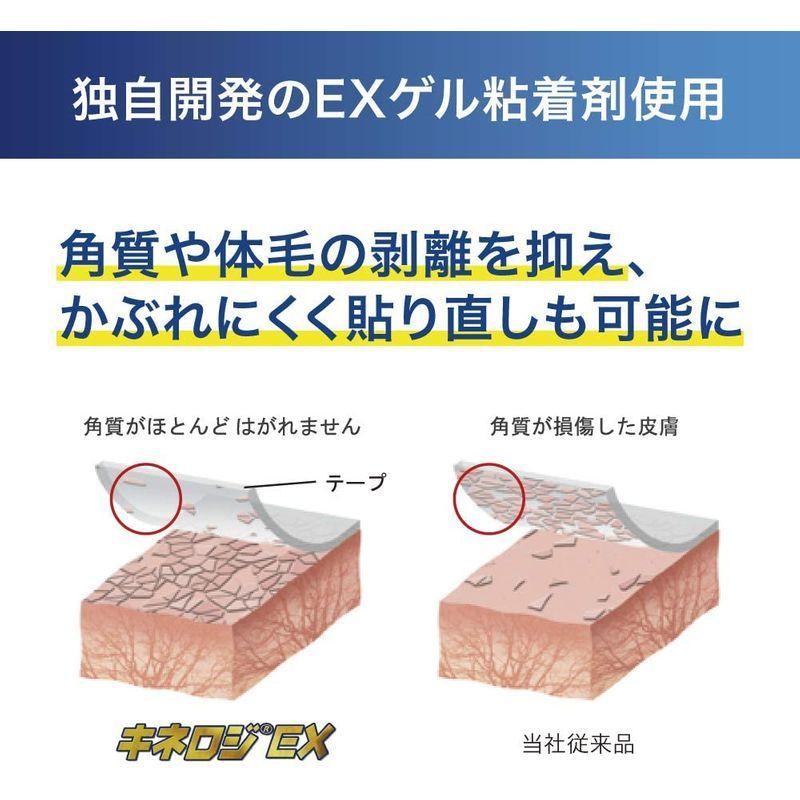 限 定 販 売 ニトリート Nitreat テーピング 50mm 5 Nkex50 キネロジex キネシオロジーテープ 伸縮タイプ 筋肉サポート用 テープ テーピング Www Projectcorfu Com