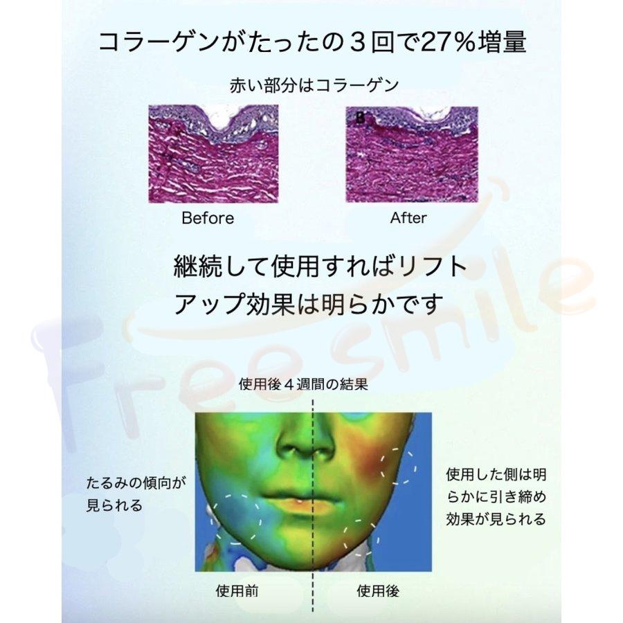 メソセラピーガン メソガン MTSメソガン マイクロニードルセラピーシステム（MTS） 