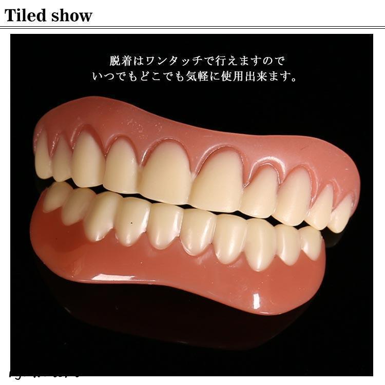 2個セット 上歯 下歯 ワンタッチ付け歯 審美歯 女性用 男性用