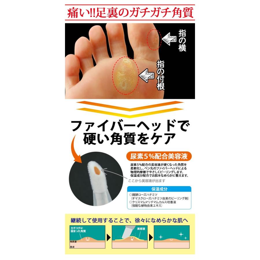 足裏 角質 ケア 尿素5 配合 美容液 ビューナ タコペン 足裏 角質ケア ピーリング タコ マメ 底まめ 角質取り フットケア 2116 ワイズのこだわりネットショップ 通販 Yahoo ショッピング