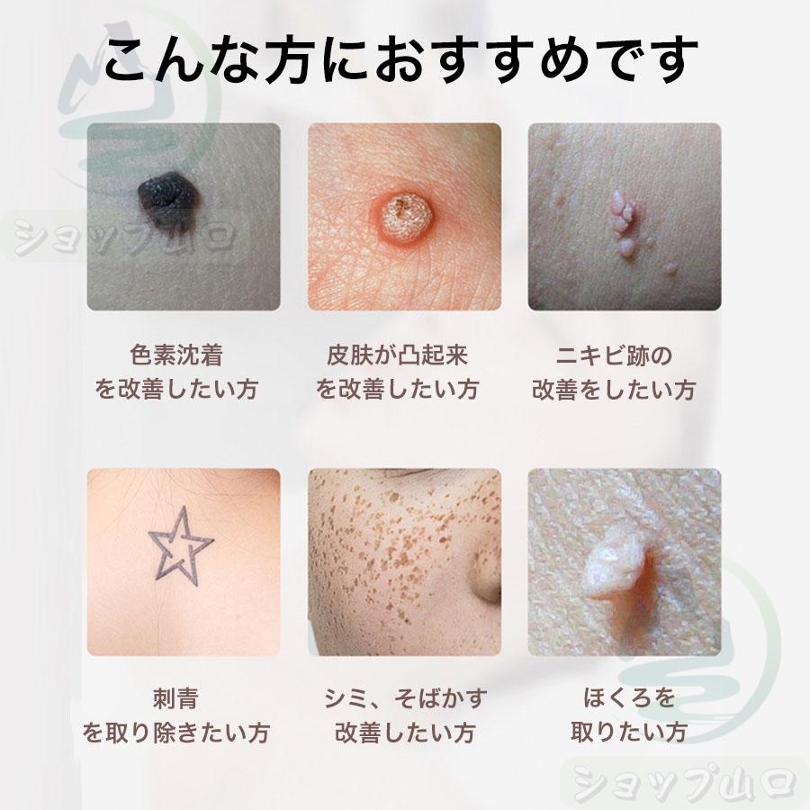 ピコレーザー 美顔器 レーザーペン シミ取り ほくろそばかす除去 シミ