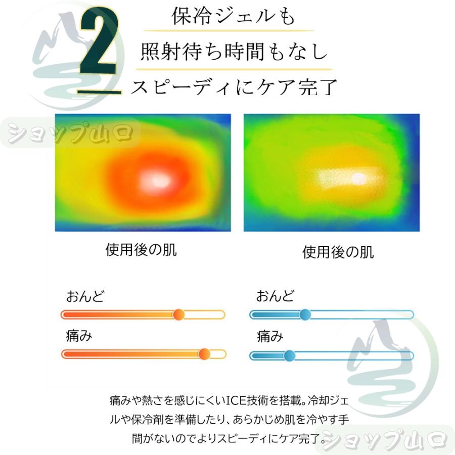脱毛器 女性 レーザー 家庭用 メンズ ipl光脱器 無痛脱毛器 美容 脱毛器 女性 レーザー 家庭用 メンズ ipl光脱器 無痛脱毛器 美容