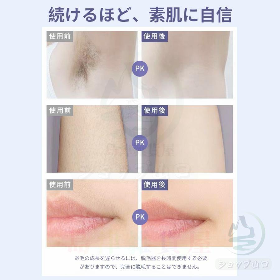 脱毛器 ipl光脱器 vio対応 無痛脱毛器 サロン級 女性 メンズ 5 脱毛器 ipl光脱器 vio対応 無痛脱毛器 サロン級 女性 メンズ 5