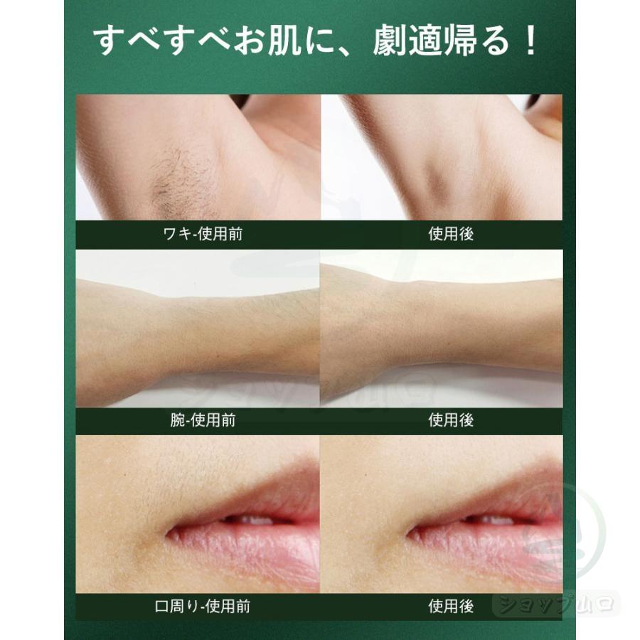 脱毛器 女性 メンズ ipl光脱器 無痛脱毛器 サロン級 5段階調節 脱毛器 女性 メンズ ipl光脱器 無痛脱毛器 サロン級 5段階調節