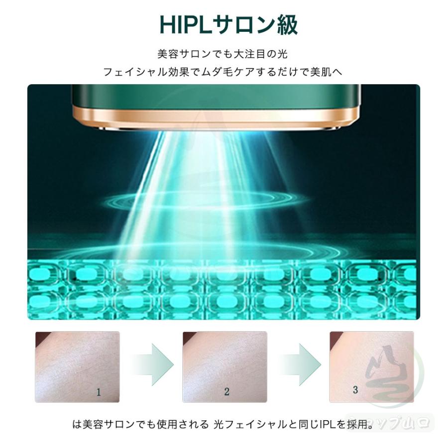 脱毛器 hipl光脱器 無痛脱毛器 サロン級 女性 メンズ 5段階調節 脱毛器 hipl光脱器 無痛脱毛器 サロン級 女性 メンズ 5段階調節