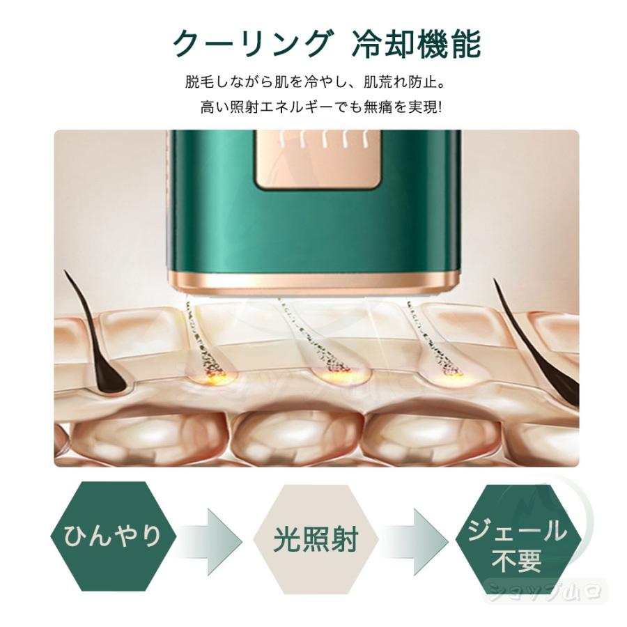 脱毛器 hipl光脱器 無痛脱毛器 サロン級 女性 メンズ 5段階調節 脱毛器 hipl光脱器 無痛脱毛器 サロン級 女性 メンズ 5段階調節