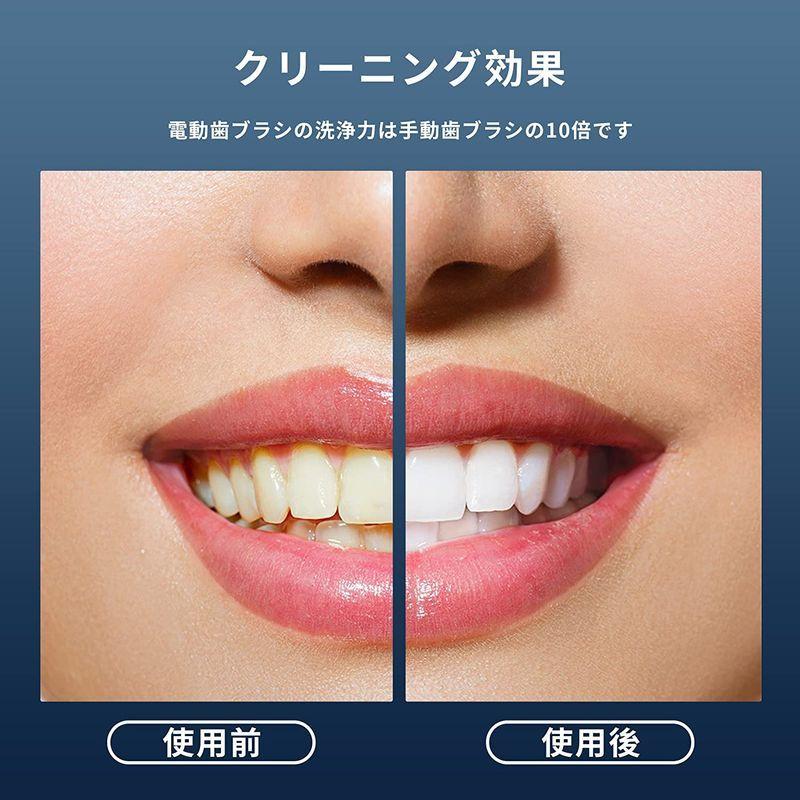 電動歯ブラシ 5つのモード タバコの歯 黄色の歯 敏感な歯茎と歯垢を持つ人々が使用できます キャリングケース付き ソニック回転歯ブラシ 黒と 5つのモード タバコの歯 黄色の歯 敏感な歯茎と歯垢を持つ人々が使用できます キャリングケース付き ソニック回転歯ブラシ 黒と