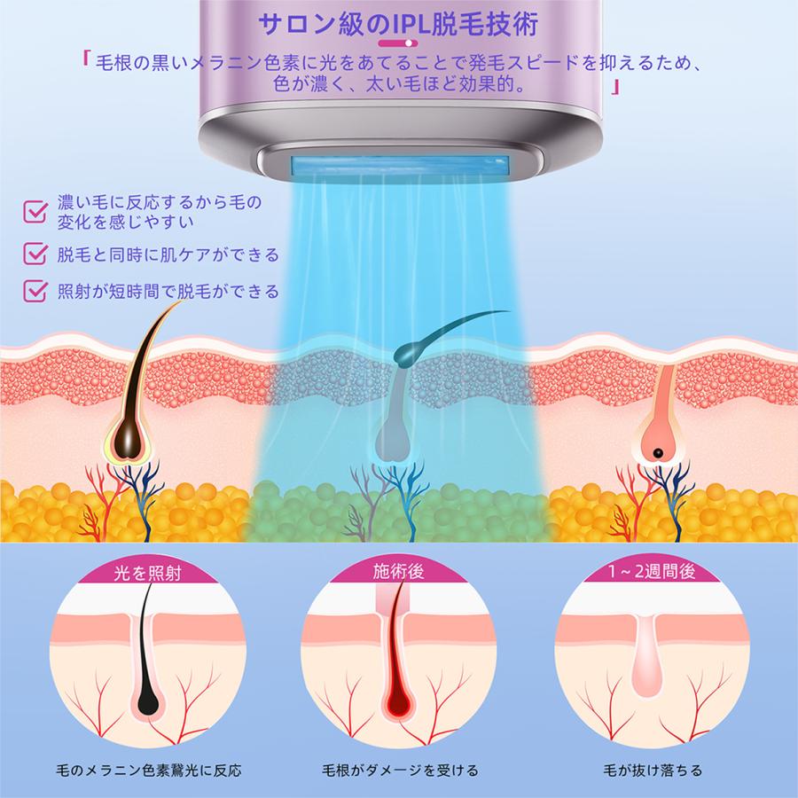 脱毛器 女性 メンズ vio対応 IPL 氷点冷感機能 光脱毛器 光美容 脱毛器 女性 メンズ vio対応 IPL 氷点冷感機能 光脱毛器 光美容