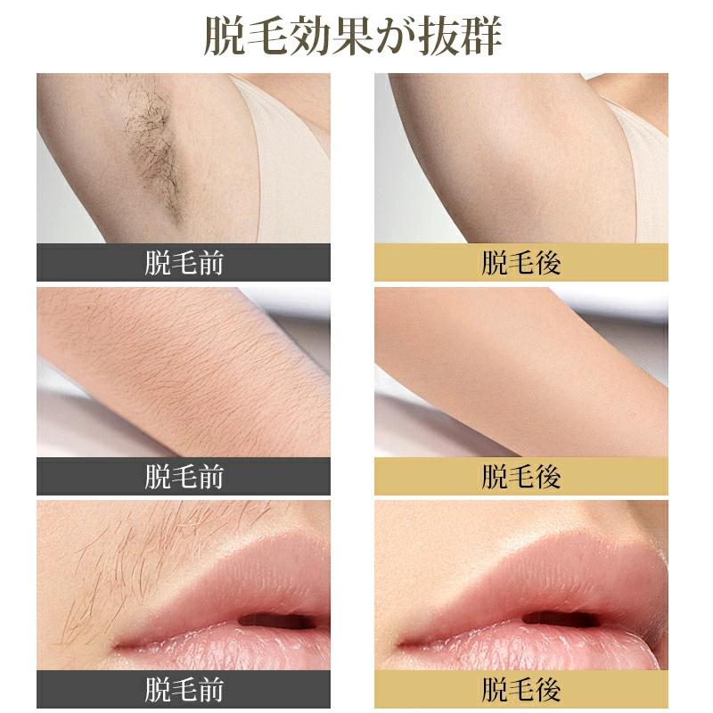 赤字覚悟!!クーポンで6980円」脱毛器 冷却 99万発照射 冷感 光 赤字覚悟!!クーポンで6980円」脱毛器 冷却 99万発照射 冷感 光