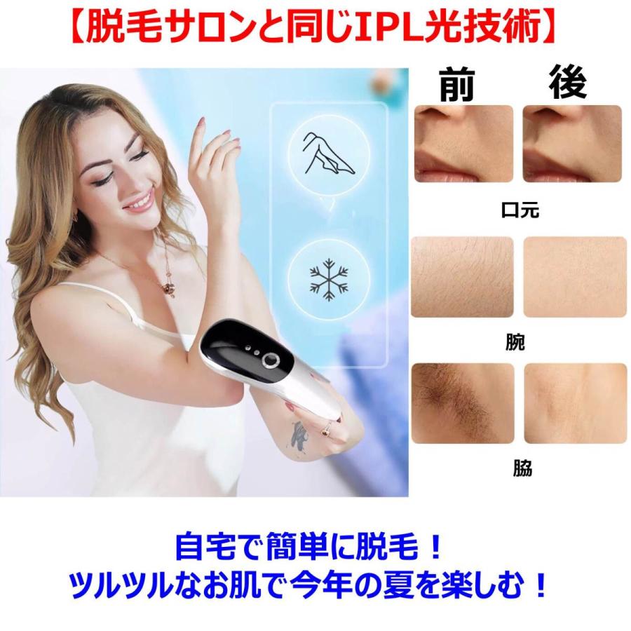 レーザー脱毛器 新型ＩＰＬ　自宅でこっそり脱毛 Amazon | 【2025新登場 IPL光脱毛器&サロン級】速い 無痛脱毛