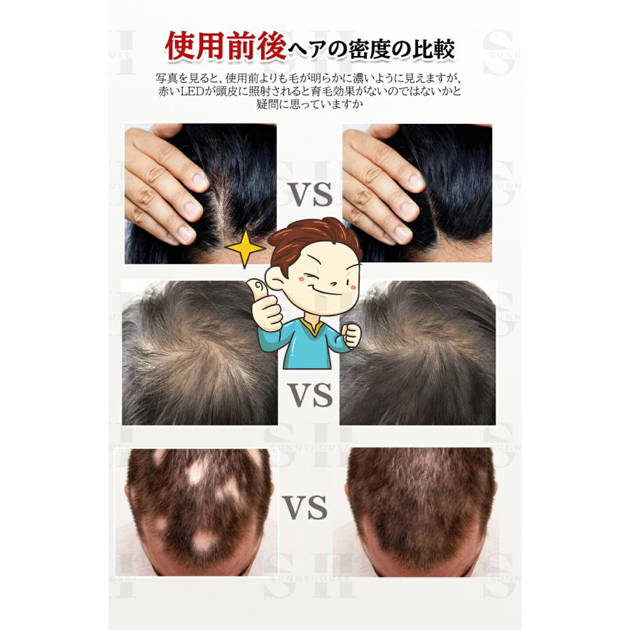 LED赤色光育毛ヘルメット 育毛ヘルメット LED 育毛キャップ