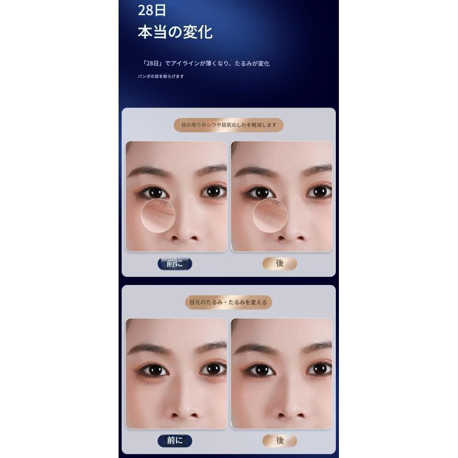 目元美顔器 目元エステ 目元ケア 温熱 美容器 超音波 メディリフトアイ