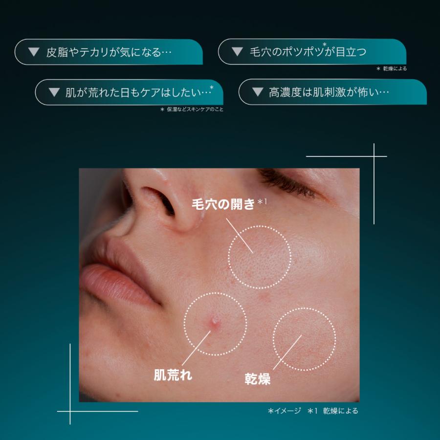 Yunth（ユンス） 生AZ 1ml×28包 美容液 アゼライン酸 おすすめ