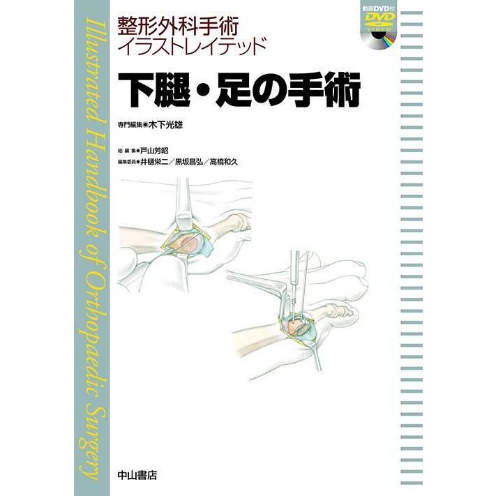 今季注目 あす楽対応  【MLNAXPMGYJ9】 限定デザイン