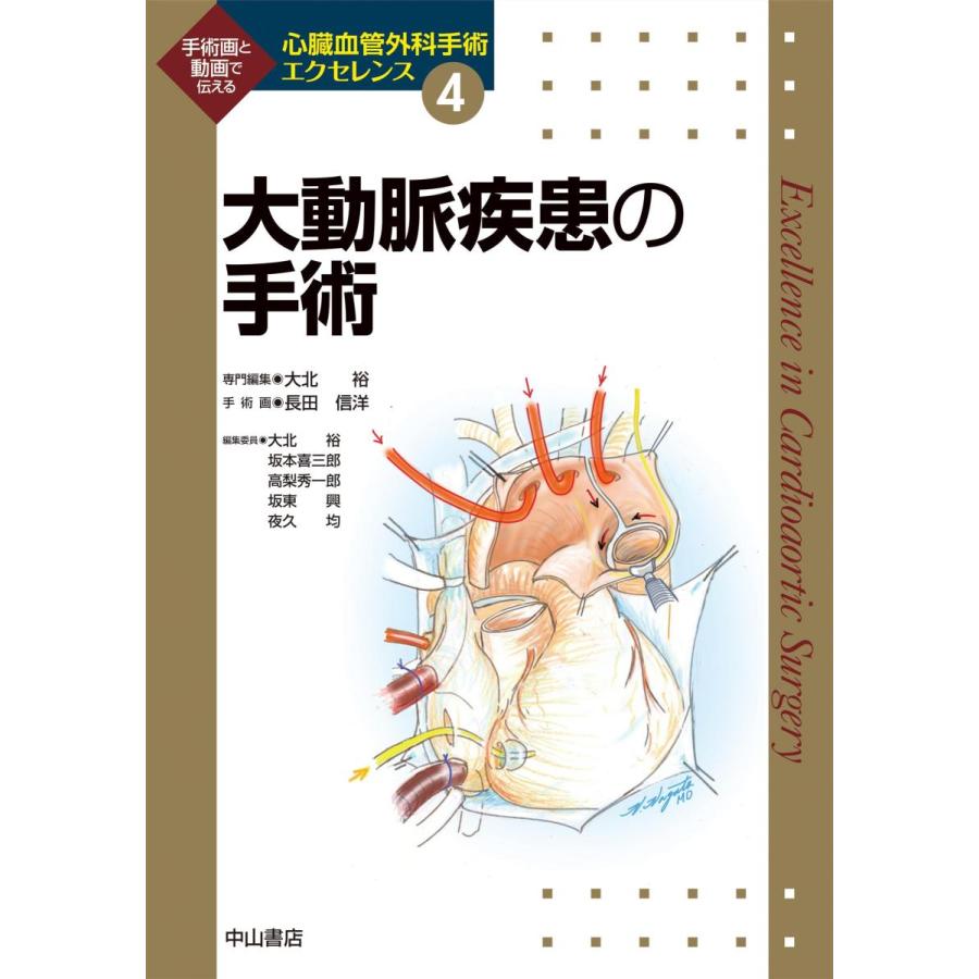 大動脈疾患の手術-手術画と動画で伝える