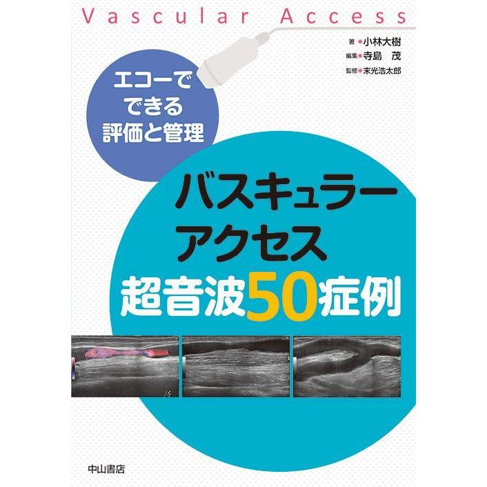 バスキュラーアクセス超音波５０症例-エコーでできる評価と管理｜yurindo