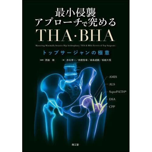 最小侵襲アプローチで究めるTHA・BHA : 有隣堂ヤフーショッピング店